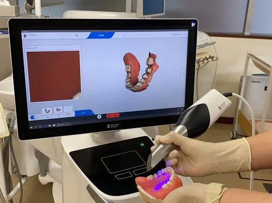 口腔内スキャナー（Primescan）