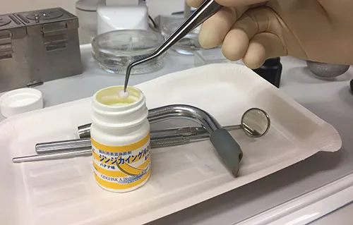 当院の虫歯治療における考え方・特徴