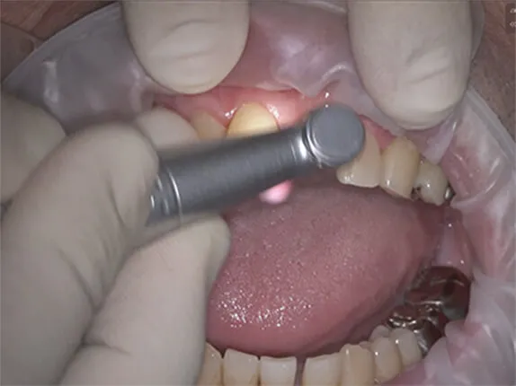 STEP1:クリーニング