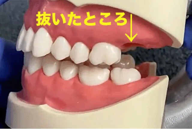 抜いたまま何もしないとは?