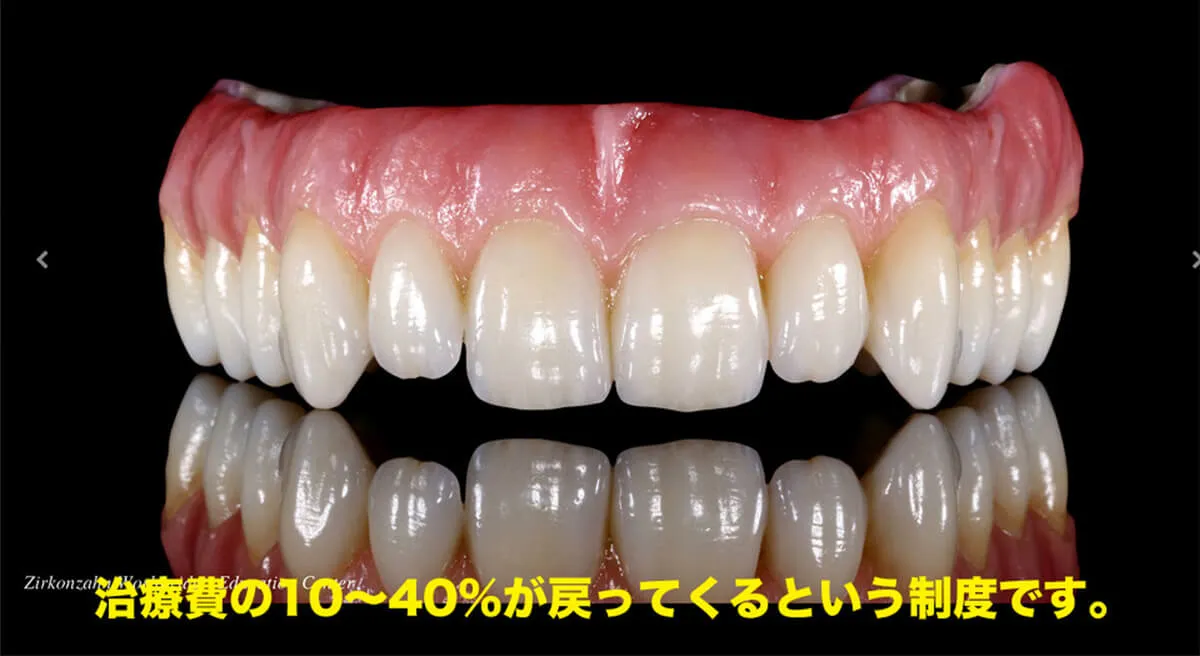 歯の模型