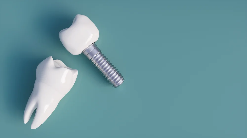 cheap-implant-4.webp