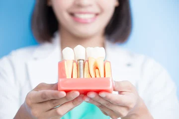 implant-doctor-2.webp