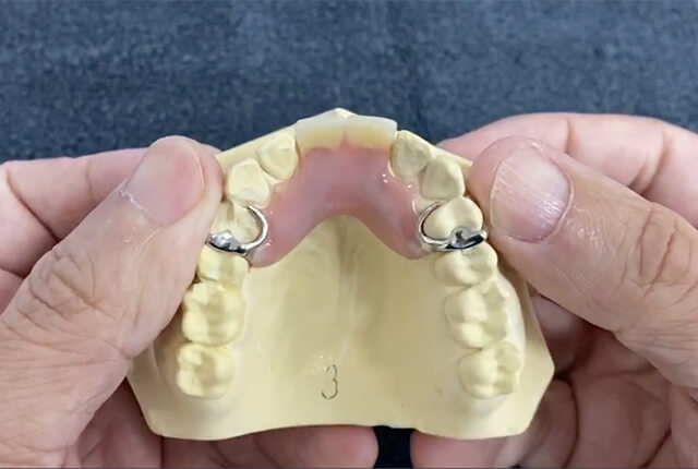 前歯の入れ歯