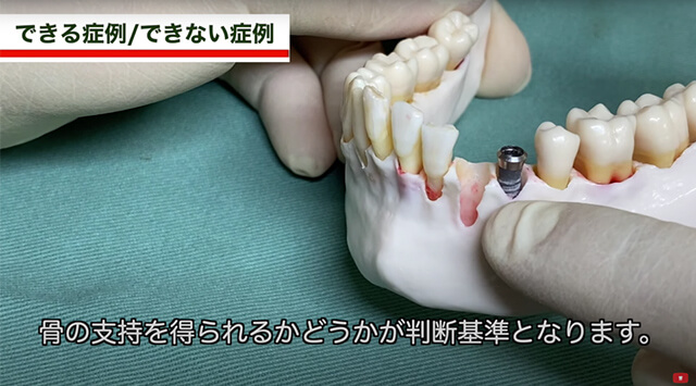 抜歯窩2