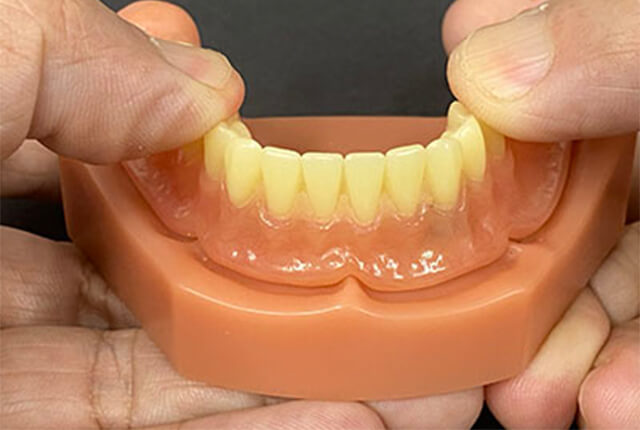 ロケーター義歯の手順6