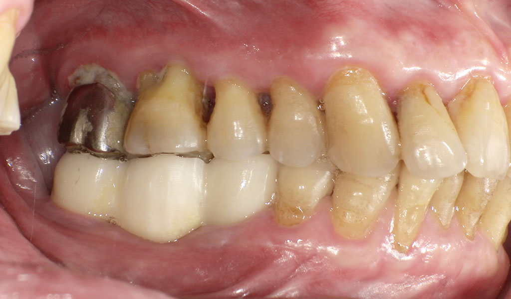 After(右下5,6,7番)