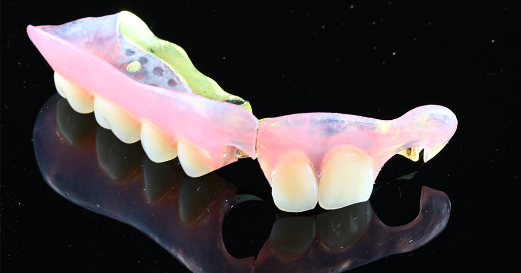 セットしたコンティース