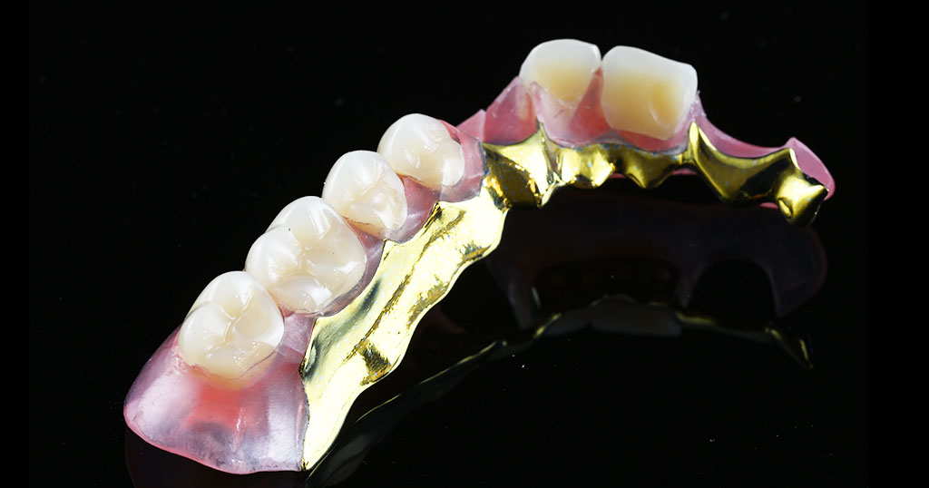 セットしたコンティース