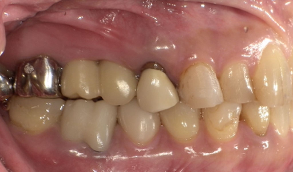 After（右上5,6番）