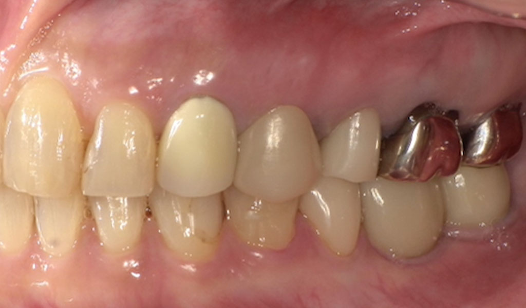 After（左上4番）