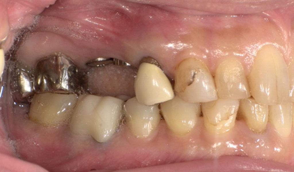 Before（右上5,6番）