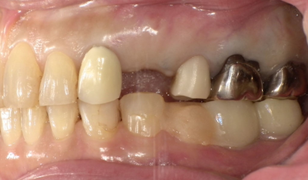 Before(左上4番）