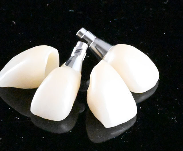 【横浜市】インプラント費用の相場と見積もりのチェックポイント